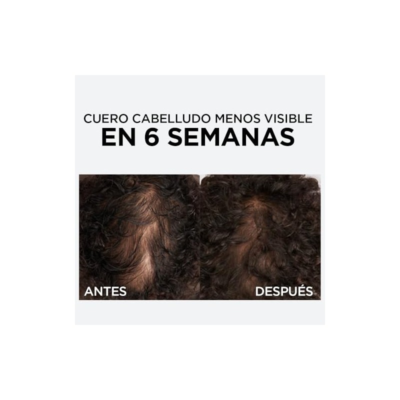L'Oréal Paris Elvive Caída Resist Sérum Capilar Anticaída, 102 ml