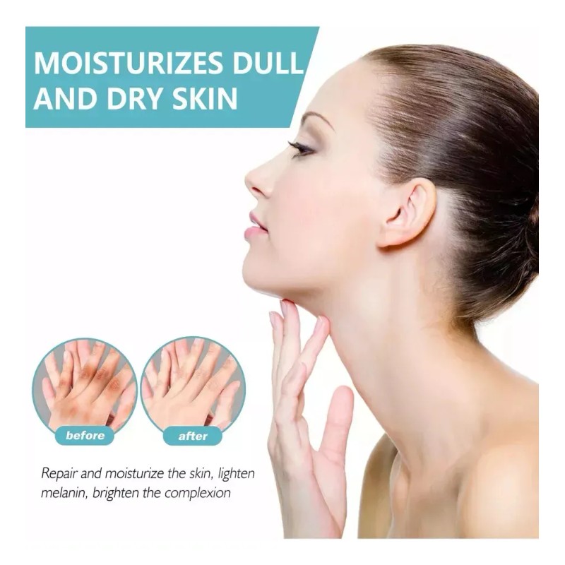 Fixderma Nigrifix Crema Para Acantosis Nigricans Fbg