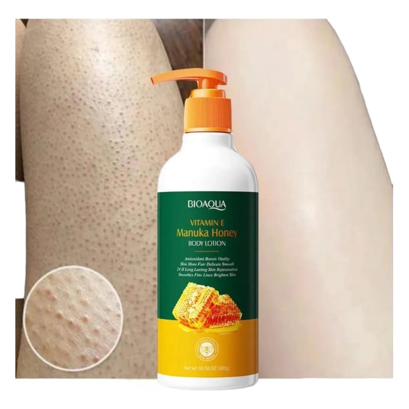 Crema Locion Extracto De Miel Quita Piel De Gallina Regenera