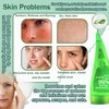 JunKuJK 99% Purity Aloe Vera Gel,260ml - Hydrating Aloe Vera