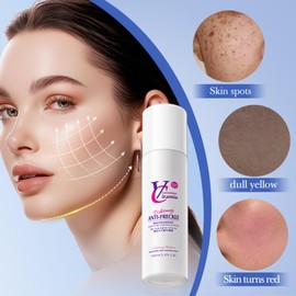 Whitening And Freckle Removing Essence, 100ml Spot Remover For Face Niacinamide Serum Reiner Fleckenentferner Für Das Gesicht, Dark Spot Corrector Serum Skin Whitening Gesichtsserum Für Alle Hauttypen