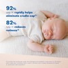 Mustela Bã‰Bã‰ Soin Croutes De Lait 40 Ml 40 ml