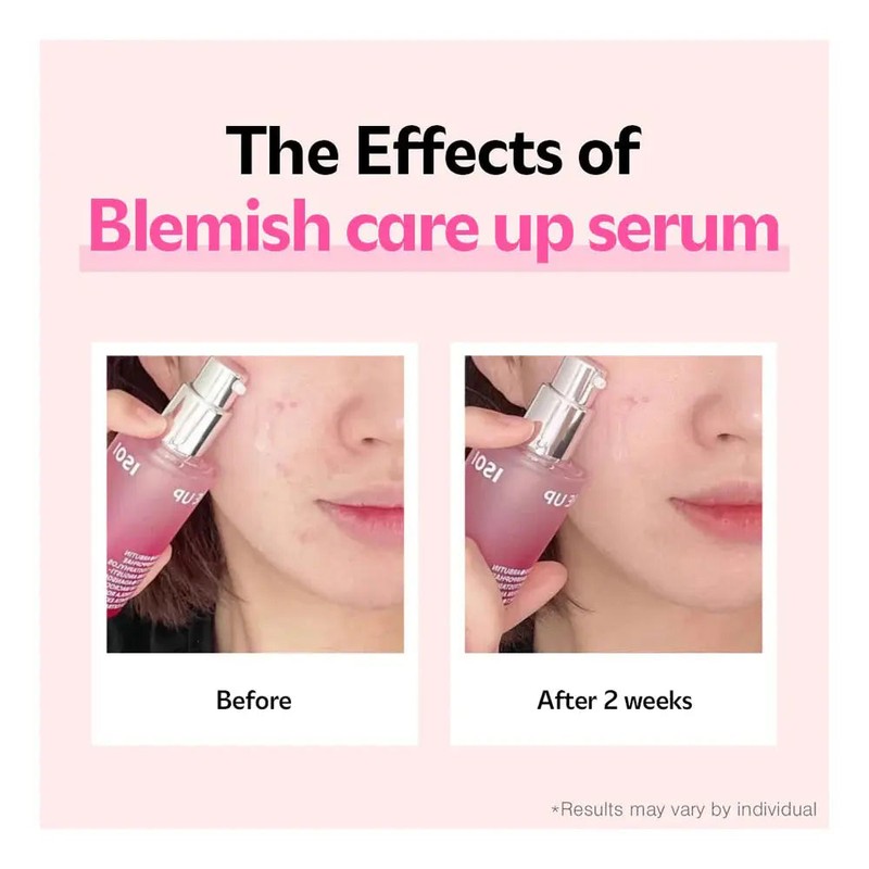 ISOI Blemish Care Up Serum, 5 ml.