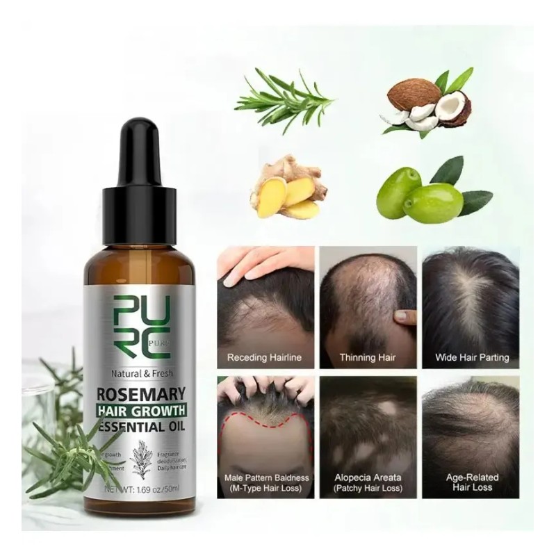 Aceite Capilar Romero Anticaída Crecimiento Control Caída 50