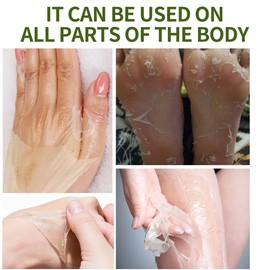 Peeling Oil for Dark Skin, Green Peeling Oil, Facial Peels with Hyaluronate,Exfoliating Peel Solution for Body, Chemical Peel At Home for Dark Spots, Body Exfoliant Peels 3.66 OZ