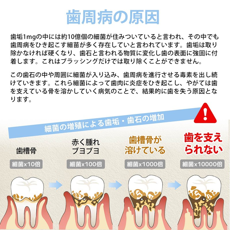 デンタルミラー 歯石取り 歯科用ミラー LEDライト付き 歯鏡 口腔 チェック 口腔ケア 歯垢 確認