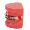 Professional Dental Demonstration Orthodontic Model with Metal Wires and Bracket