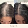  inde wild Champi Hair Oil,Ayurvedic Hair Growth Oil