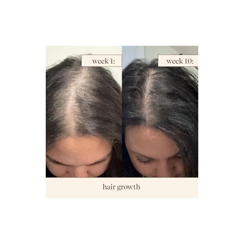  inde wild Champi Hair Oil,Ayurvedic Hair Growth Oil