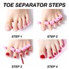 RTRTGS 8-Piece Toe Separator, Sponge Toe Separator, Soft Foam Finger