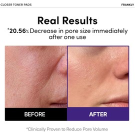 FRANKLY Pore Closer Toner Pads l Rice Jelly Pads with 9 Peptides, Vegan Collagen, Rice Extract l Pore Minimizer l Hydrating for All Skin Types l Korean Skin Care | 70 Count