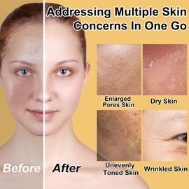 Lifting & Firming Anti-Aging Skin Care Set Kit for Women Teens,Niacinamide Retinol Serum,Hyaluronic Acid Serum,Skincare Gift Set,Facial Skin Care Products,Face Care Routine Kit Christmas Gift Women