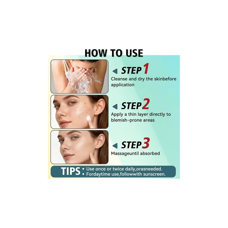 Tratamiento Para El Acné Facial, Crema Antiacné, Crema Para