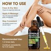 2 Pcs Cyperus Rotundus Oil for Hair Removal