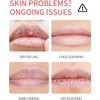 8PC Bálsamo Labial Hidratante con Aceite de Coco y Vitaminas