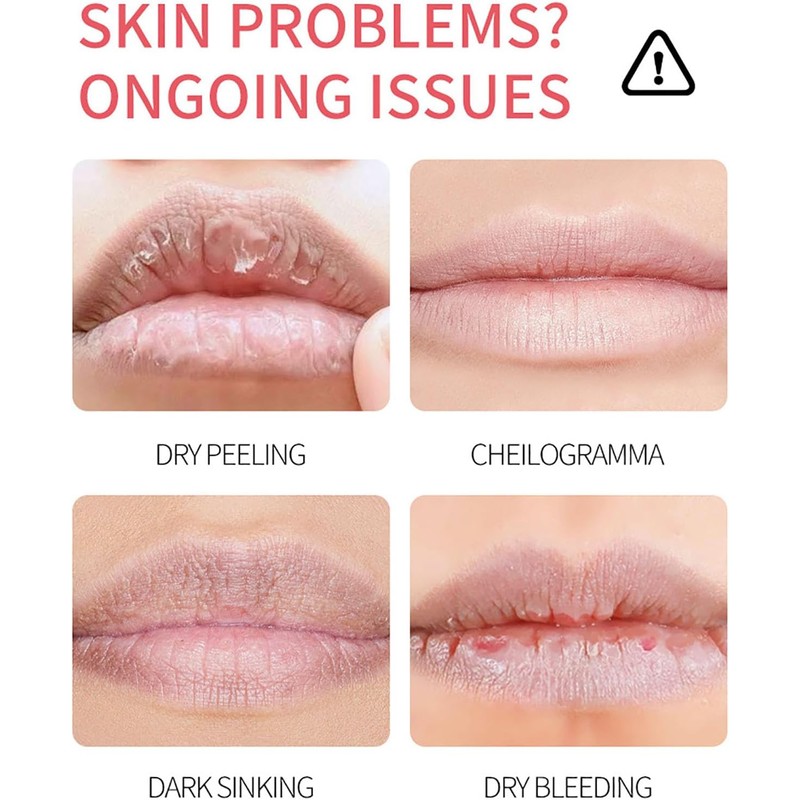 8PC Bálsamo Labial Hidratante con Aceite de Coco y Vitaminas