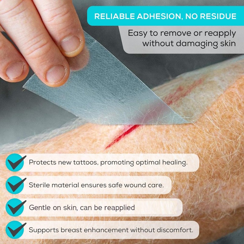 MedVance Soft Silicone Tape with Perforation for Easy Cut Size