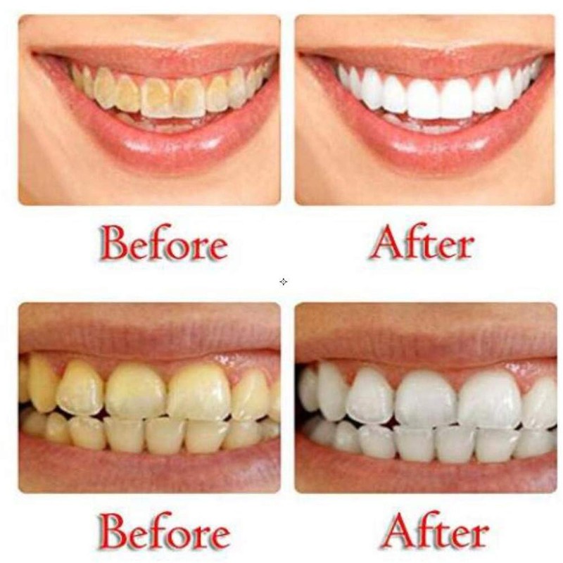 Vista Activated Carbon Toothpaste Pack of 2 Bamboo Toothpaste White