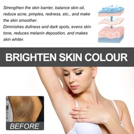 Snow Bleach Cream For Private Part, Skin Whitening Cream for Armpits, Bleaching Cream for Intimate Area, Cream for Whitening Dark Skin for Neck, Elbow, Inner Thigh, Pack of 2