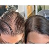 Shampoo Reviving Farmasi Caida Cabello