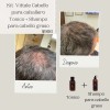 Paquete Tónico Y Shampoo Para Cabello Graso Tónico Vittale