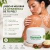 Crema De Melagenina Y Piperina Para Vitíligo 70gr