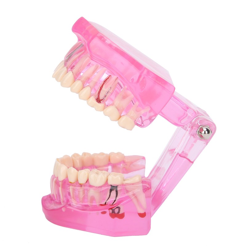 Transparent Adult Teeth Model Pathological Repair Studying Dental Teaching Tools