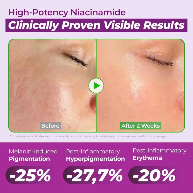 Jumiso Niacinamide Dark Spot Serum Txa Tranexamic