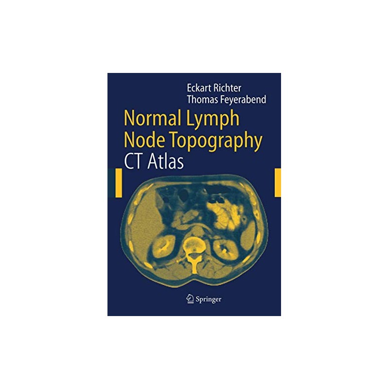 Normal Lymph Node Topography: CT Atlas
