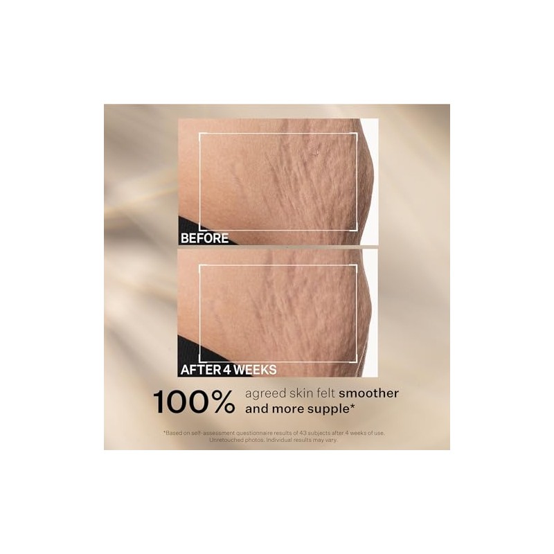 StriVectin SD Advanced PLUS Intensive Humectante ataca la pérdida de