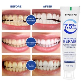 Fengyang® Hydroxylapatit Zahnpasta, Hydroxyapatite Toothpaste, Fluoridfreie Zahnpasta, FüR Empfindliche ZäHne Und Aufhellung, Linderung Von Zahnempfindlichkeit