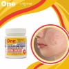 Arymar 9% Sulfur Ointment, Acne Spot Treatment for Face &