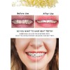 500 pcs Orthodontic Elastic Bands Dental Orthodontic Elastics Latex Rubber