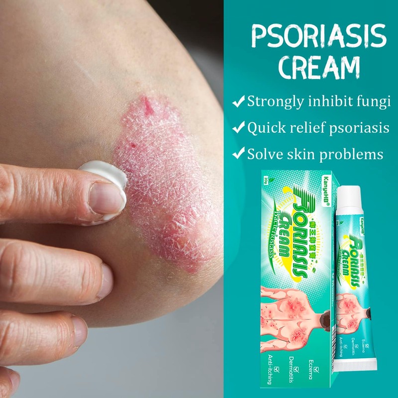 Crema Para Psoriasis Y Eczema, Crema Natural A Base De