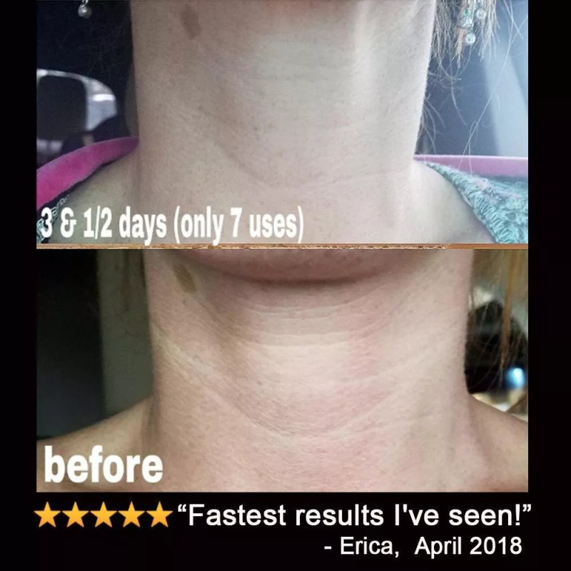 Lilyana Naturals Retinol Crema Hidratante 1,7 Onzas