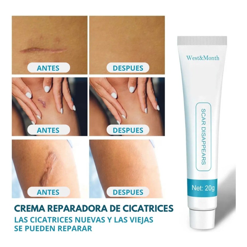 Crema Manchas Despigmentante Melasma Acné Paño Cicatrices