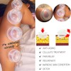 4 Sizes Cupping Therapy Set-Professional Cupping Therapy Studio and Household