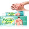 Crema Para Psoriasis Y Eczema, Crema Natural A Base De