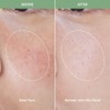 Meebak Cica Redness Solution Cream 50ml - Meebak Cica Redness