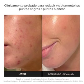 Paula's Choice SKIN PERFECTING 2% BHA Liquid Exfoliant with Salicylic Acid, Facial Polish for Pores, Wrinkles & Fine Lines, Suitable for Blackhead-Prone Skin, Fragrance-Free