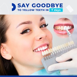 LUELLI Professional Teeth Whitening Pen for a White Smile - 4 Tooth Stain Remover Gel Pens with 35% Carbamide Peroxide - Home Dental Products for Sensitive Teeth