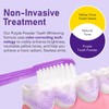 Purple Teeth Whitening Powder, 2025 New Tooth Restoration Mineral- Powder,