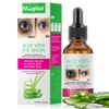 30ml Aloe Vera Augenserum, Augenpflege, Augencreme Gegen Augenringe und Schwellungen,