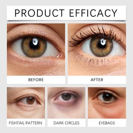 2 * 10ML Eye Roller for Dark Circles and Puffy Eyes,Anti Wrinkle Eye Cream,Hydrating & Moisturizing Serum,Under Eye Bag for Dark Circle Removal and Fine Lines,Na/tural Roll-On for Tired Eyes