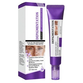 Advanced Anti Hyperpigmentation Cream, 20g Hyperpigmentation Treatment Facial Cream, Deep Cleansing Dark Spots Remover Corrector for Face, Brightening Anti Pigmentation Removal Cream