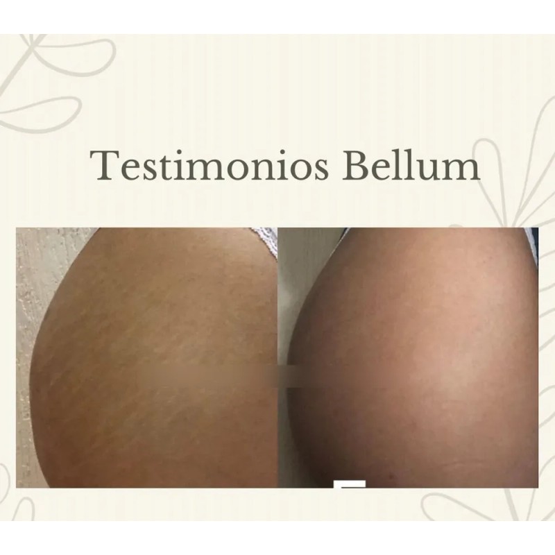 Bellum Crema Corporal Para Las Estrias Reafirmante Natural Algas Marinas