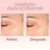 Serum 4 En 1 - Vitamina C + Ácido Hialurónico
