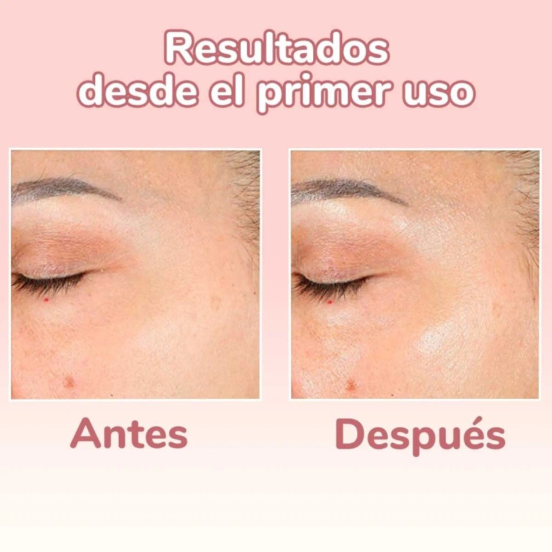 Serum 4 En 1 - Vitamina C + Ácido Hialurónico
