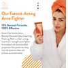AcneFree Severe Acne 10% Benzoyl Peroxide Foaming Cleansing Wash, 5