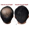 Fibras Capilares De Queratina 27.5g Abundancia Cabello Topik